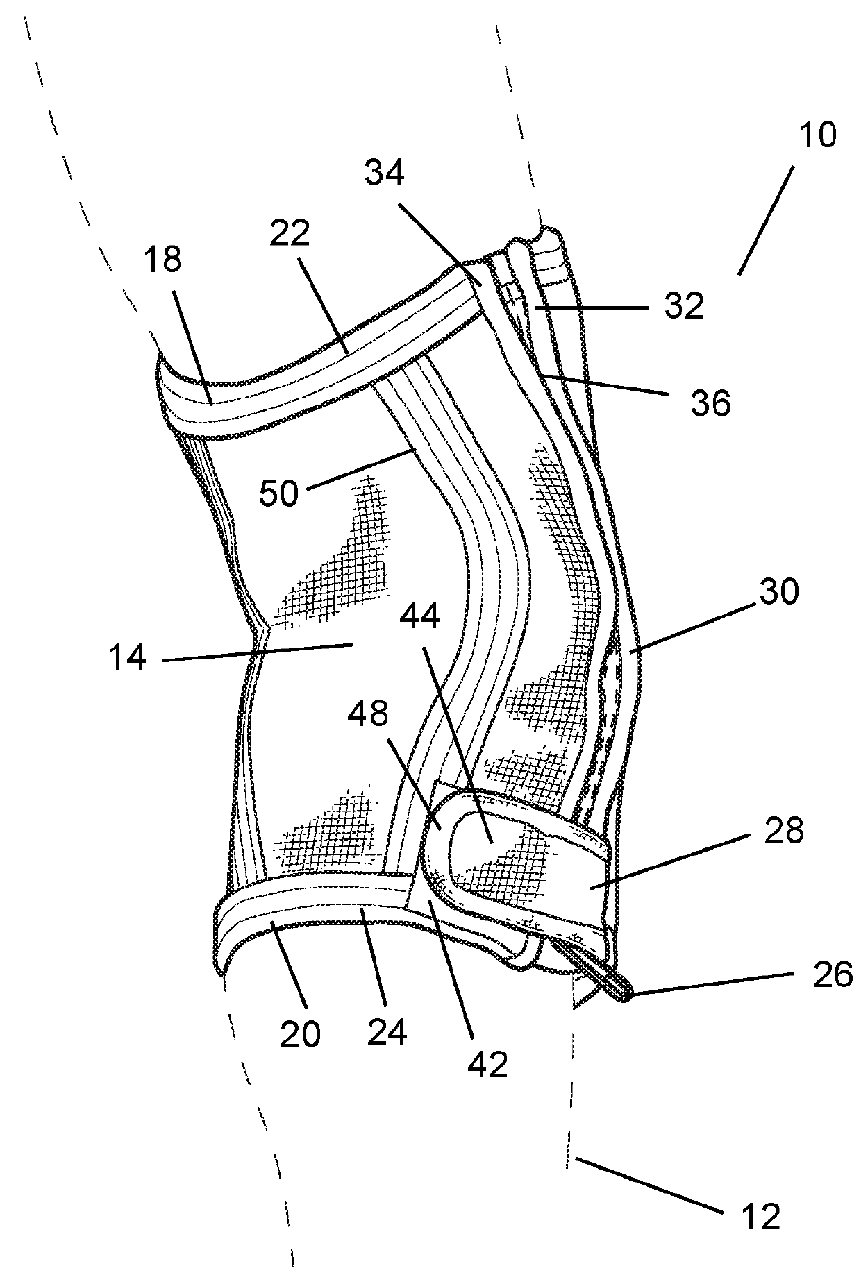 Removable Joint Sleeve