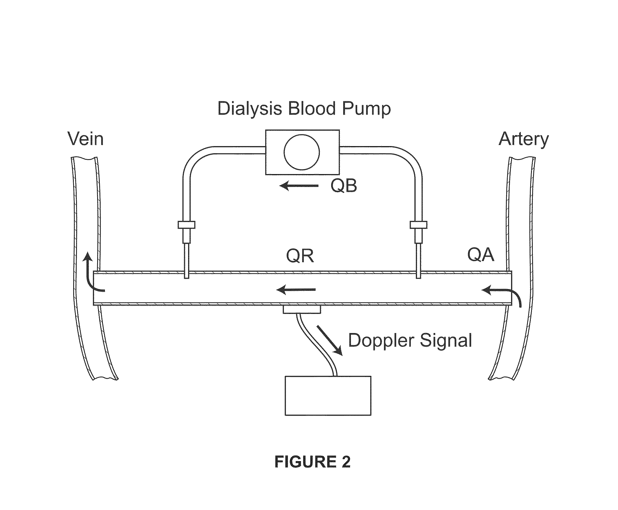 Linear magnetic drive transducer for ultrasound imaging