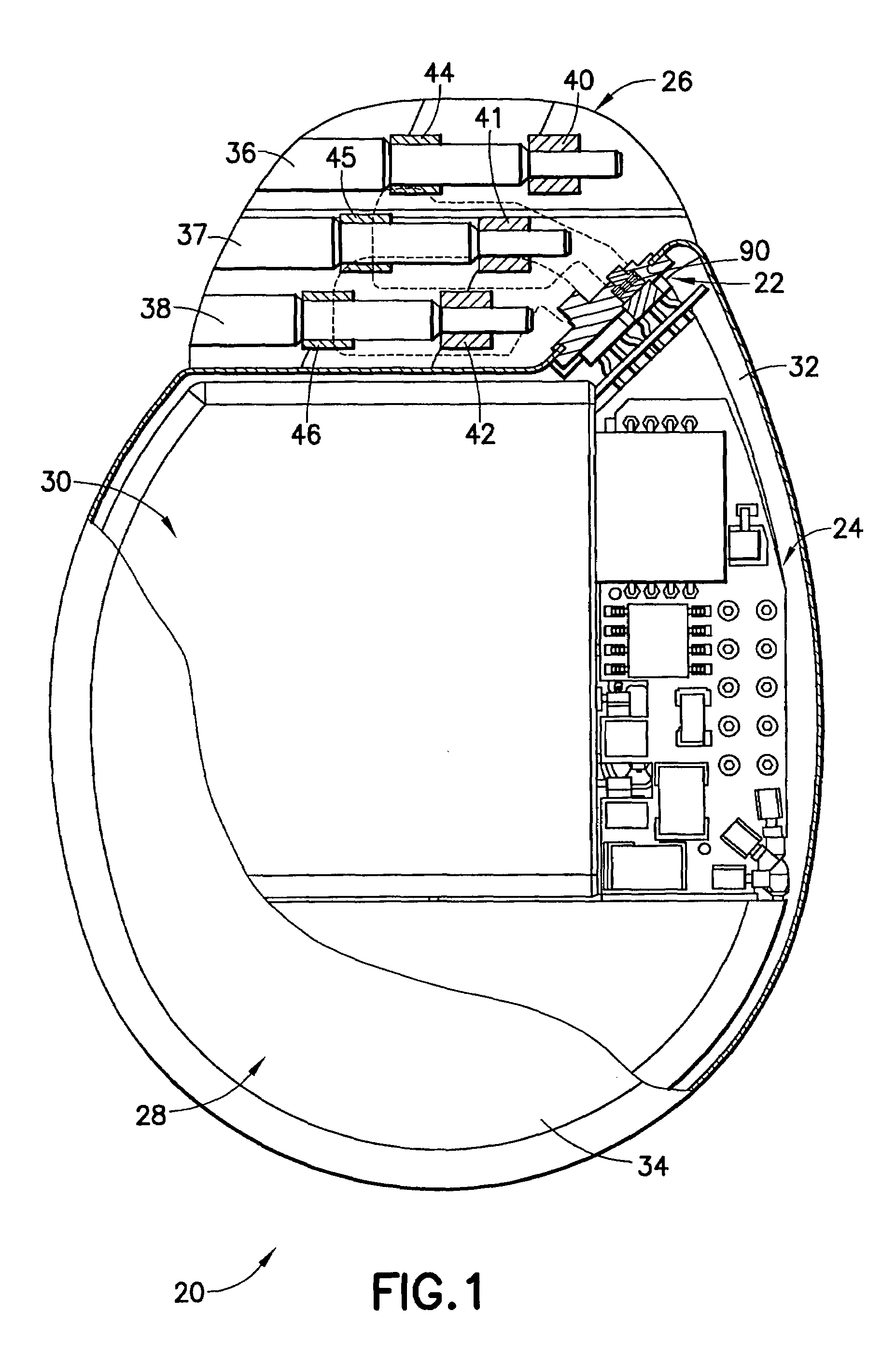 Integrated 8-pole filtered feedthrough with backfill tube for implantable medical devices