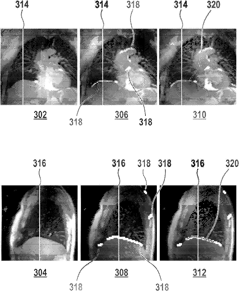 Automated sequential planning of mr scans