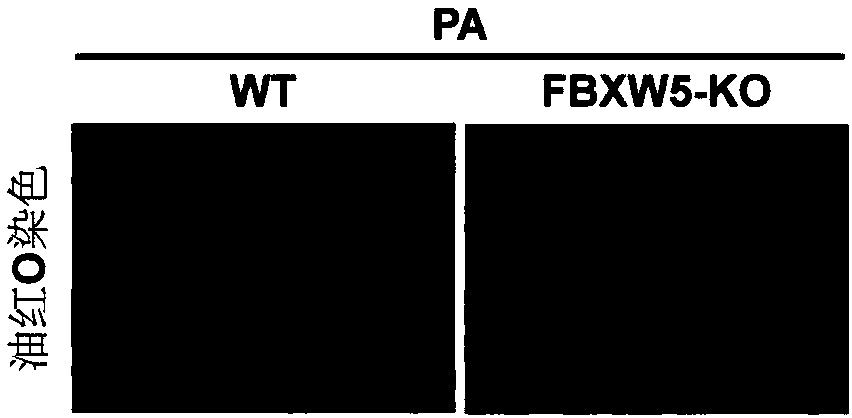 Application of FBXW5 and FBXW5 inhibitor to preparation of medicine for treating fatty liver and related diseases