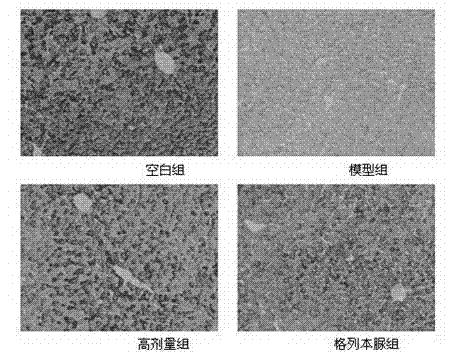 Application of dioscin in preparing medicament for preventing and treating diabetes mellitus