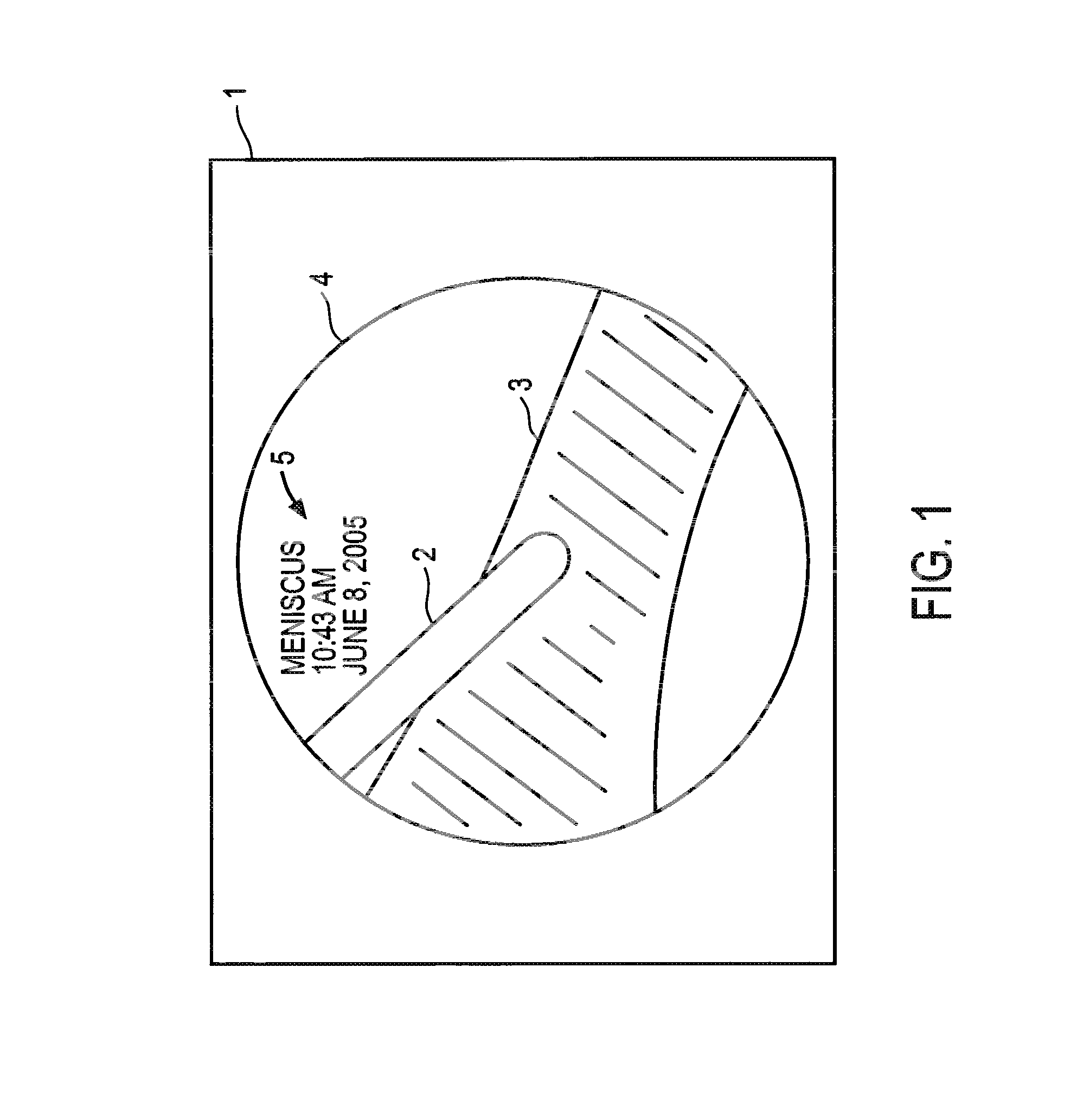 Voice-responsive annotation of video generated by an endoscopic camera