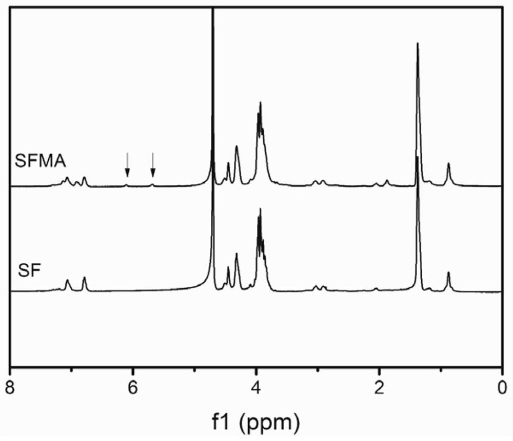 Gelatin-silk fibroin hydrogel loaded with adipose-derived stem cells and plasma as well as preparation method and application of gelatin-silk fibroin hydrogel