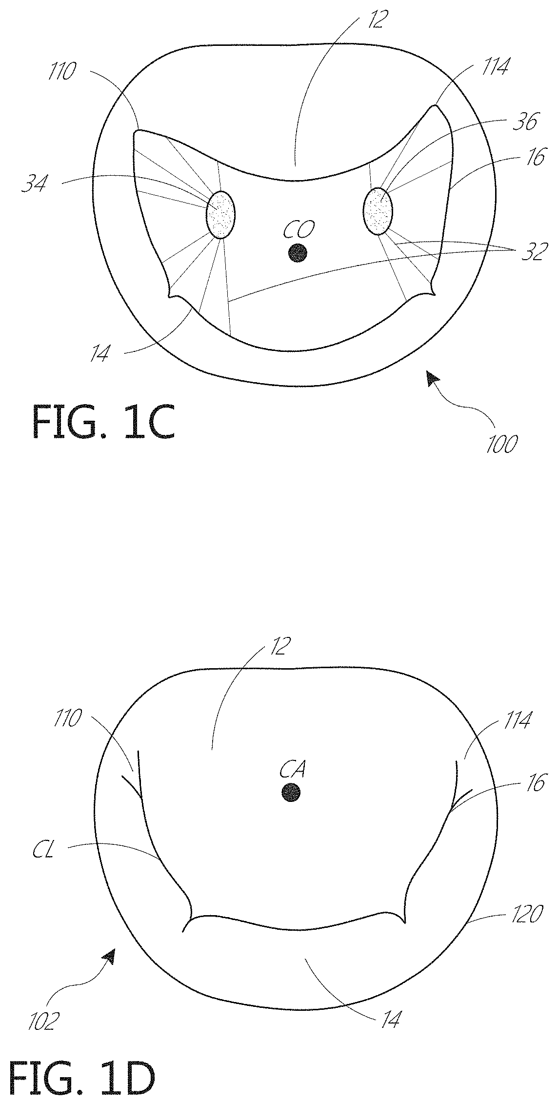 Device, system, and method for transcatheter treatment of valvular regurgitation