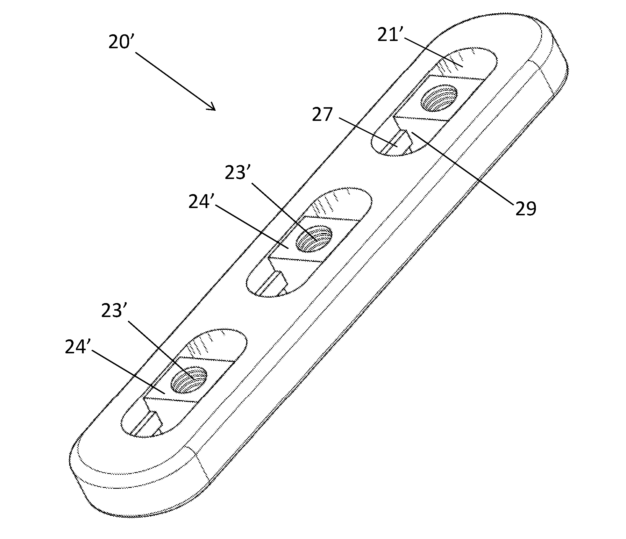 Flexible locked plate fixation