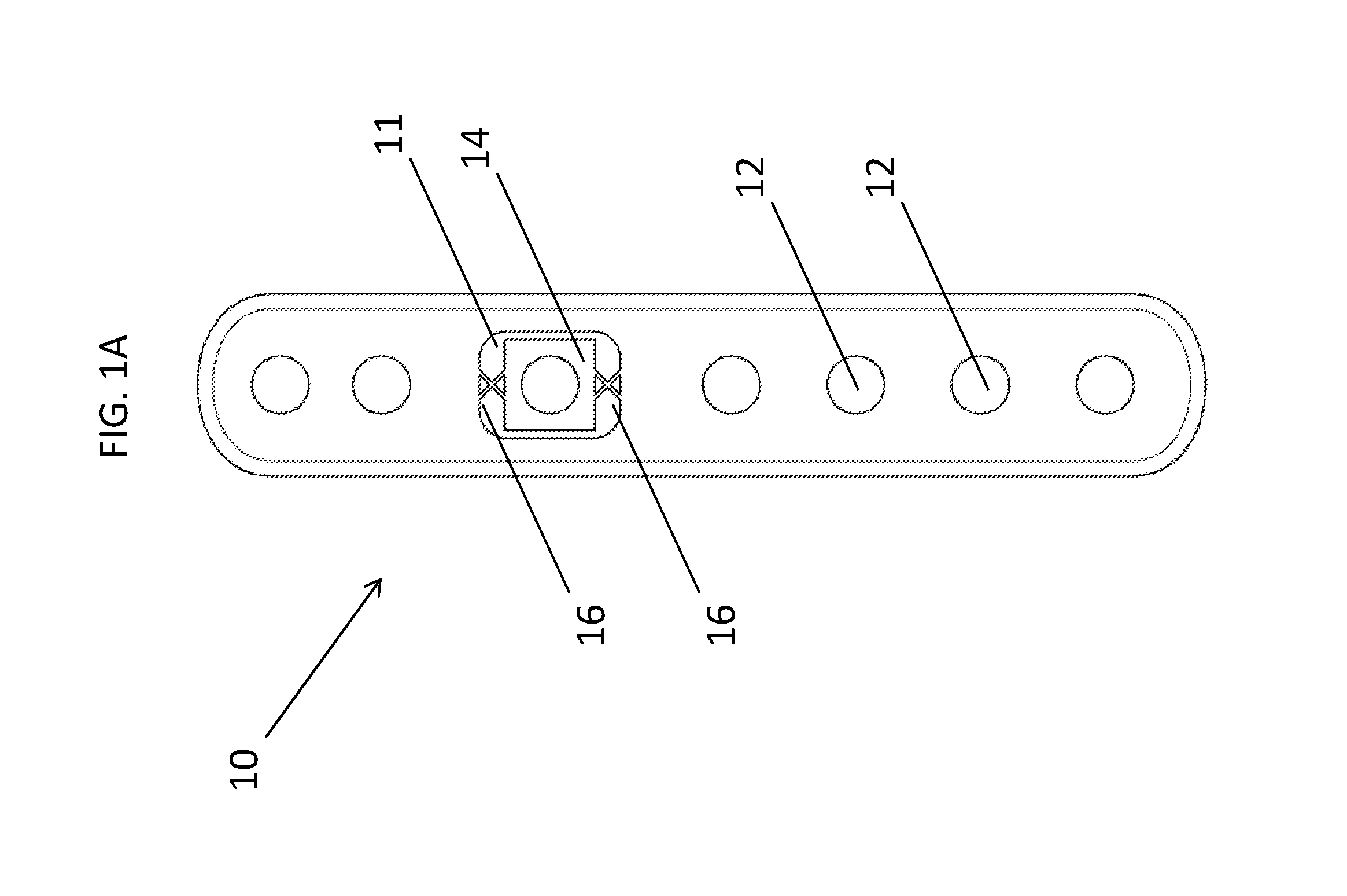 Flexible locked plate fixation