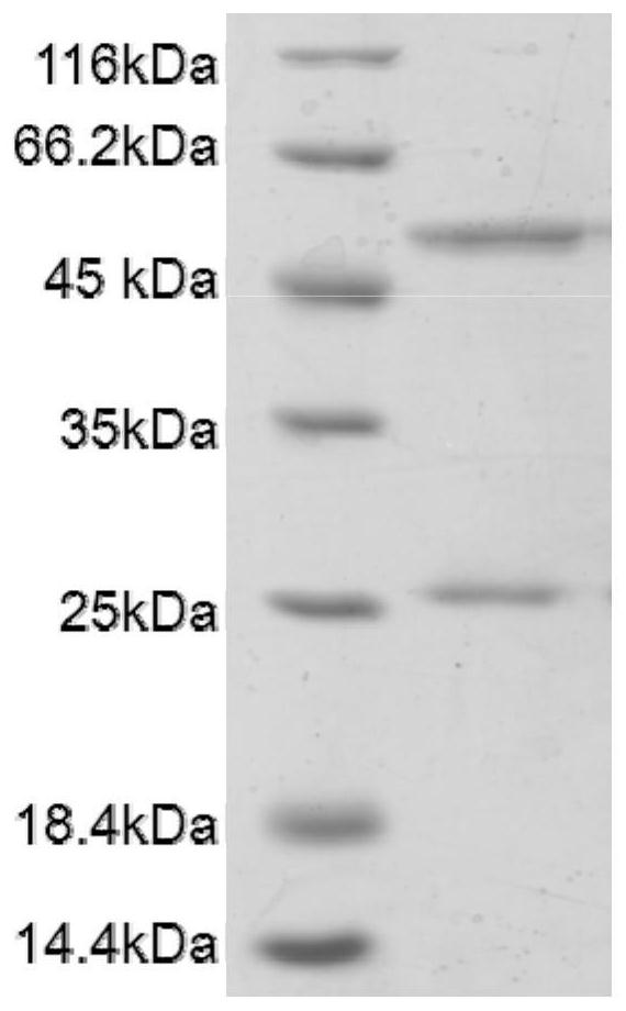 A mouse-derived monoclonal antibody neutralizing type A botulinum toxin and its application