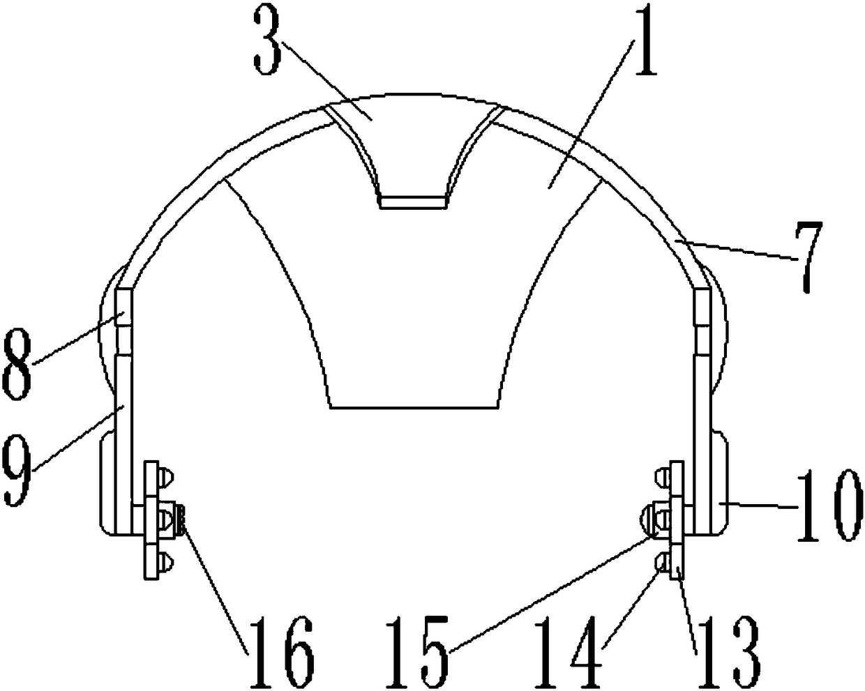 Auxiliary deafness therapy device