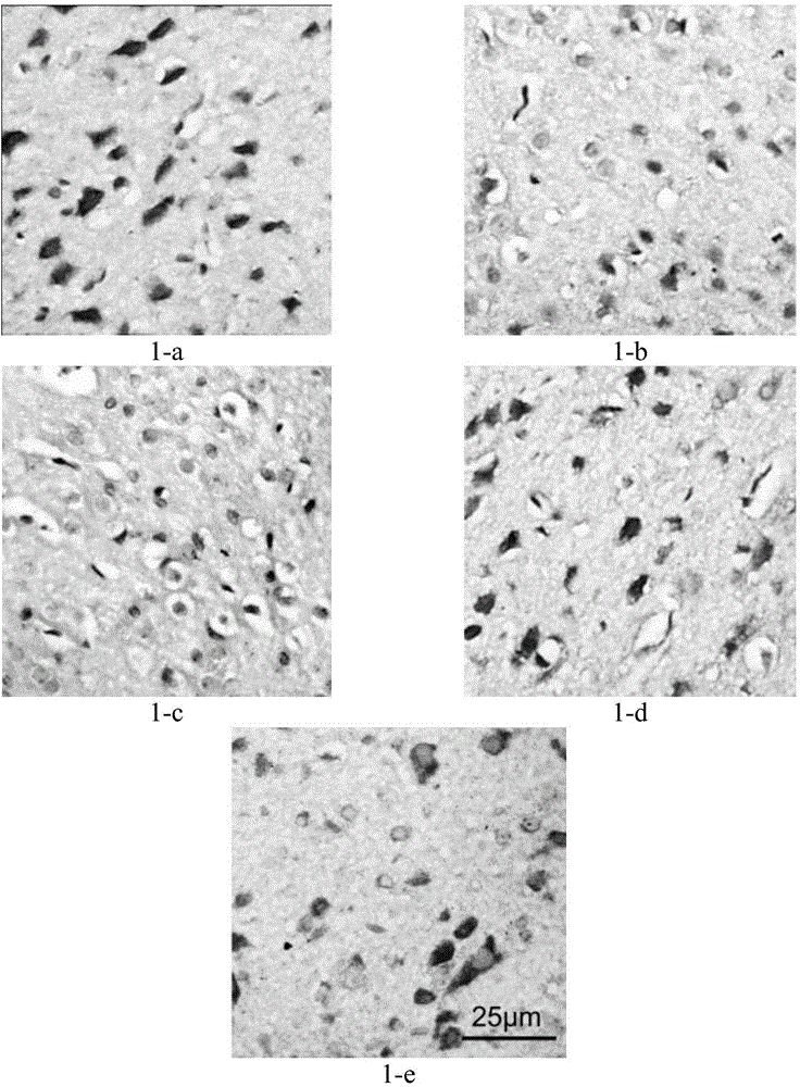 Medicine composition and application thereof