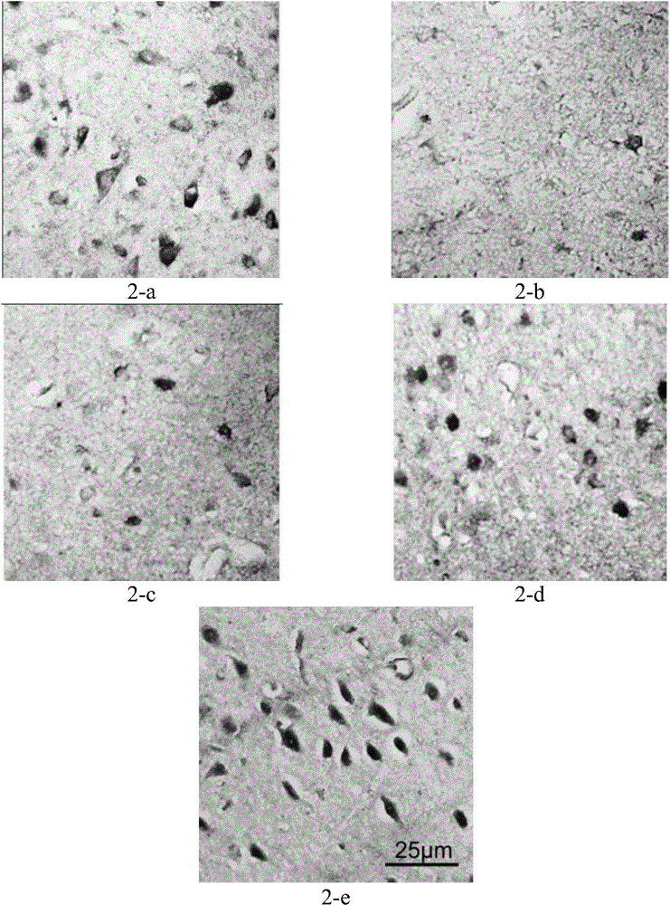 Medicine composition and application thereof