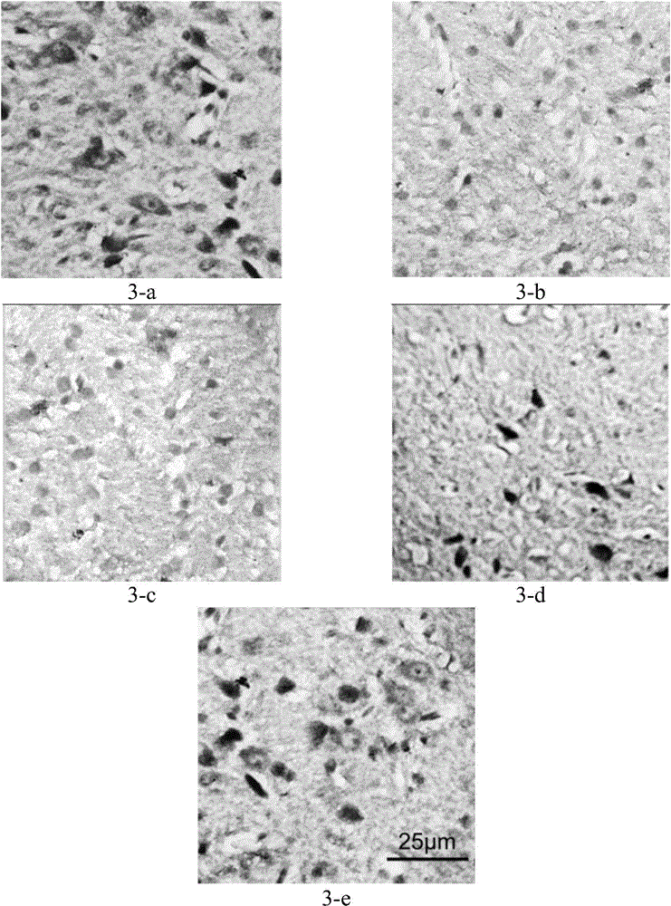 Medicine composition and application thereof