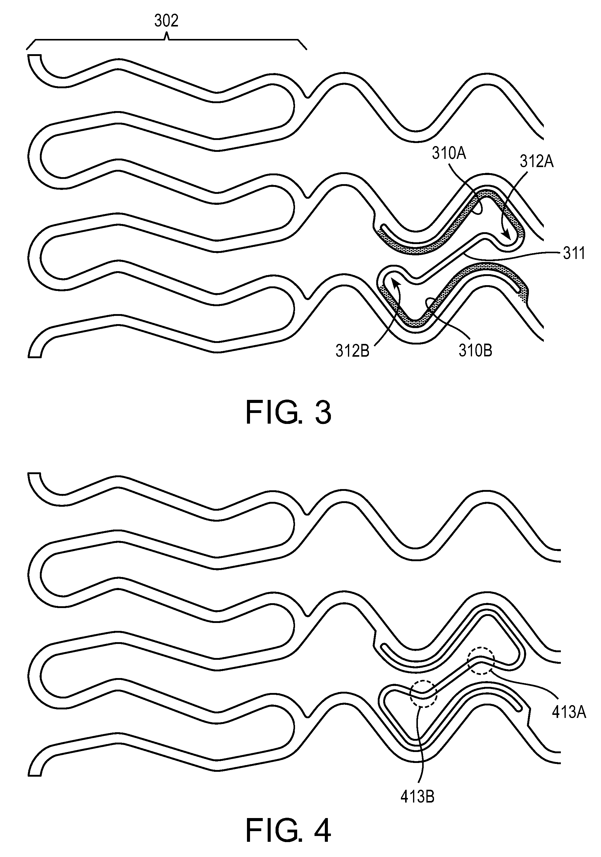 Expandable Prostheses for Treating Atherosclerotic Lesions Including Vulnerable Plaques