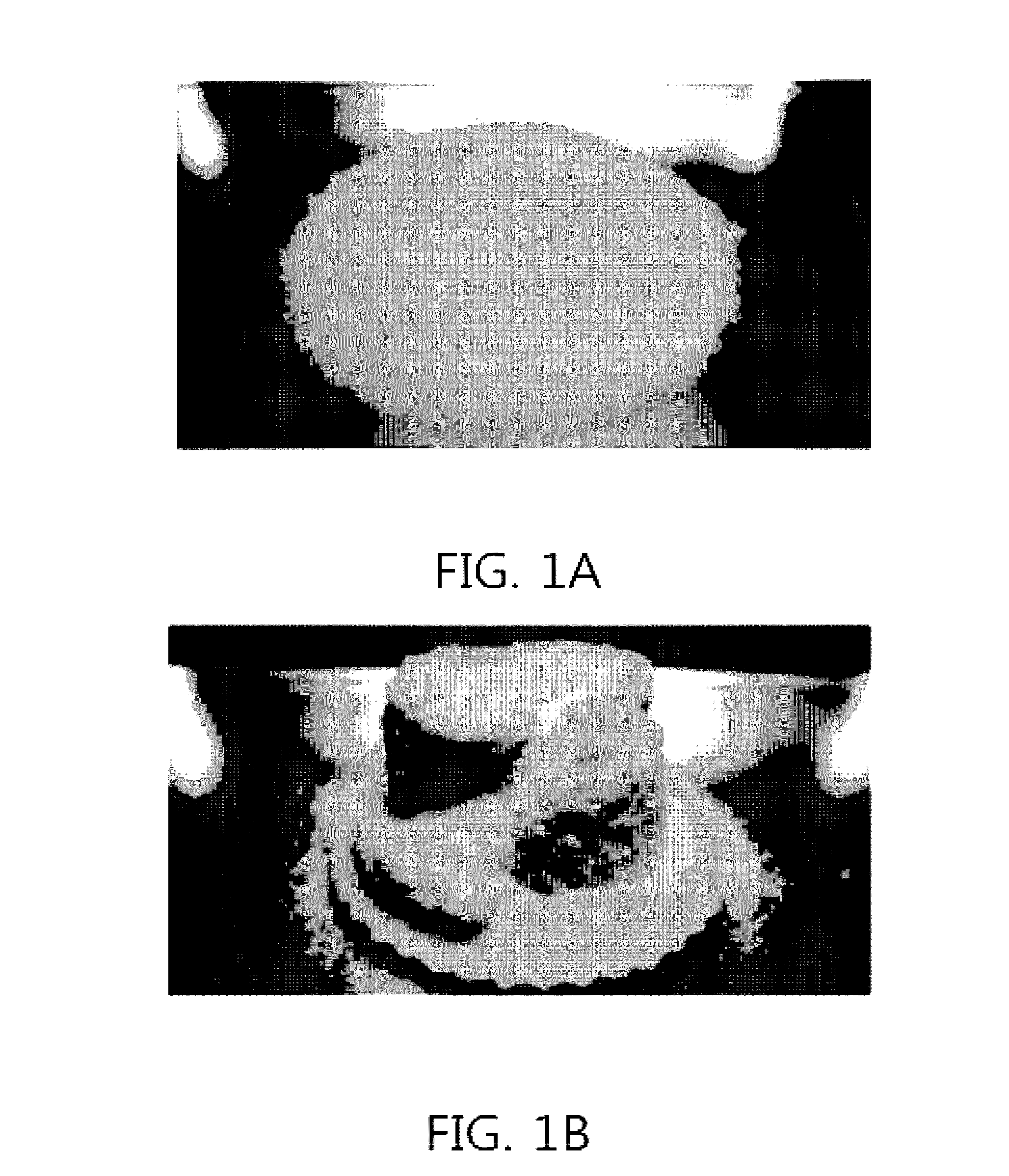 Super absorbent resin having improved solidification resistance, and method for preparing same