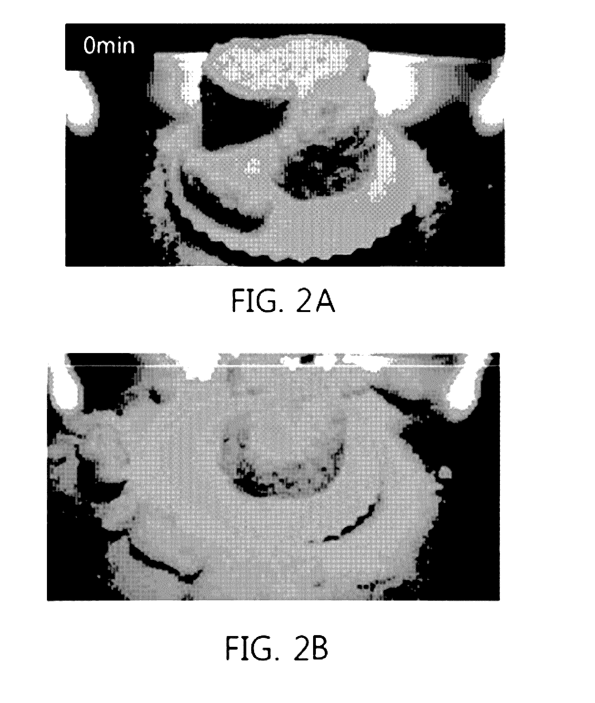 Super absorbent resin having improved solidification resistance, and method for preparing same