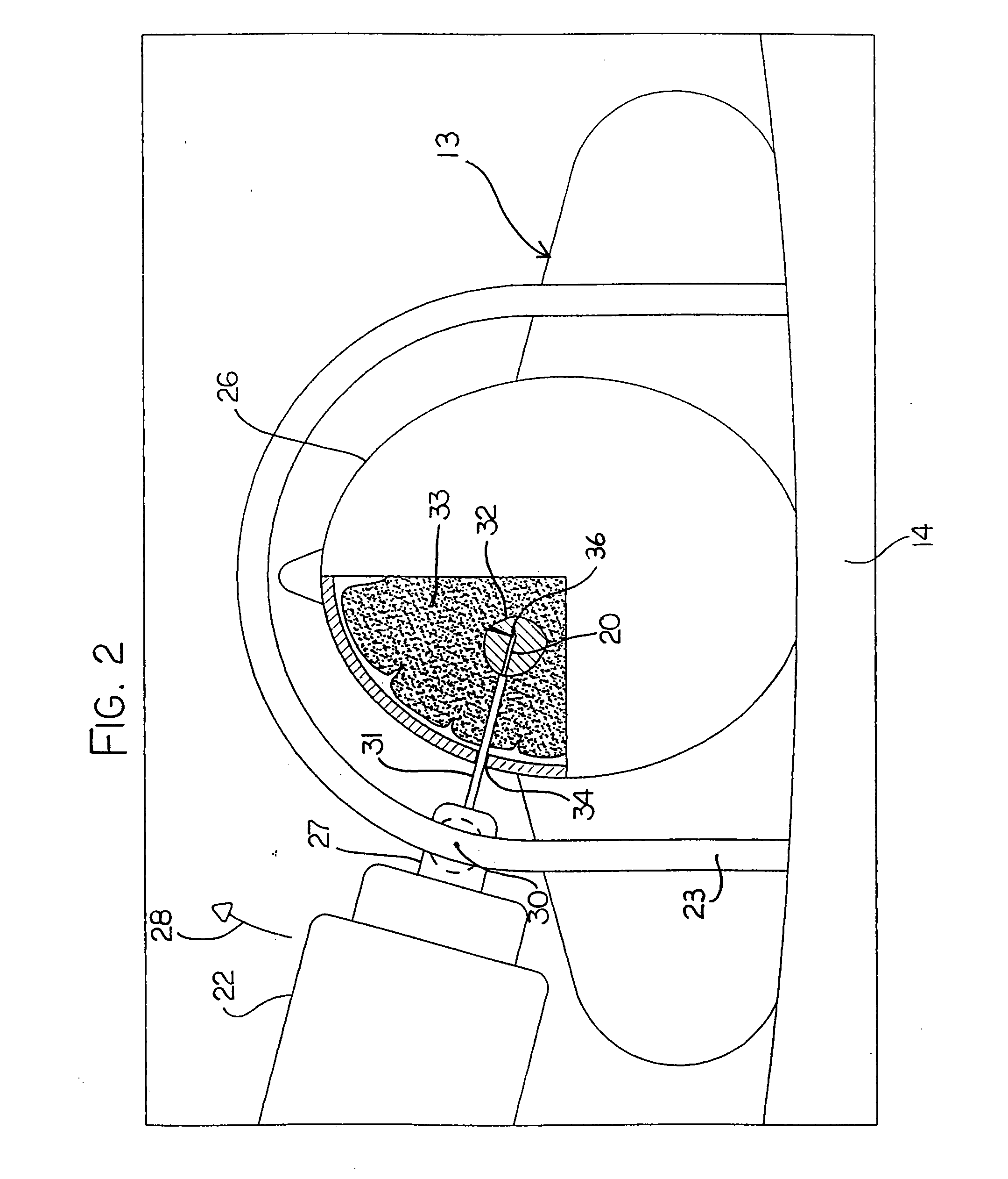 Hyperthermia Treatment and Probe Therefor