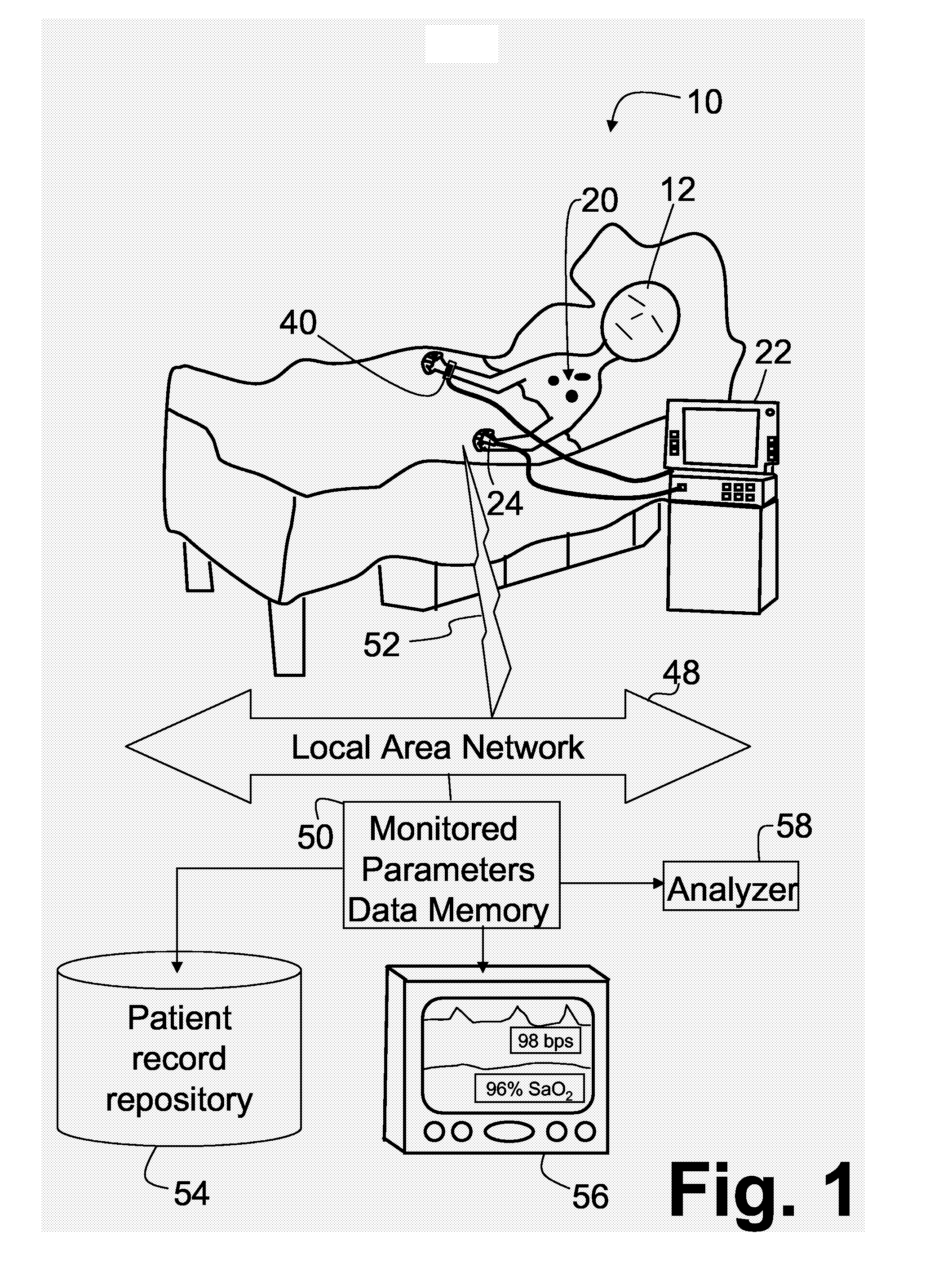 Apparatus To Measure The Instantaneous Patients' Acuity Value