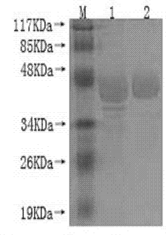 Riemerella anatipestifer antibody indirect ELISA method detection kit and application thereof