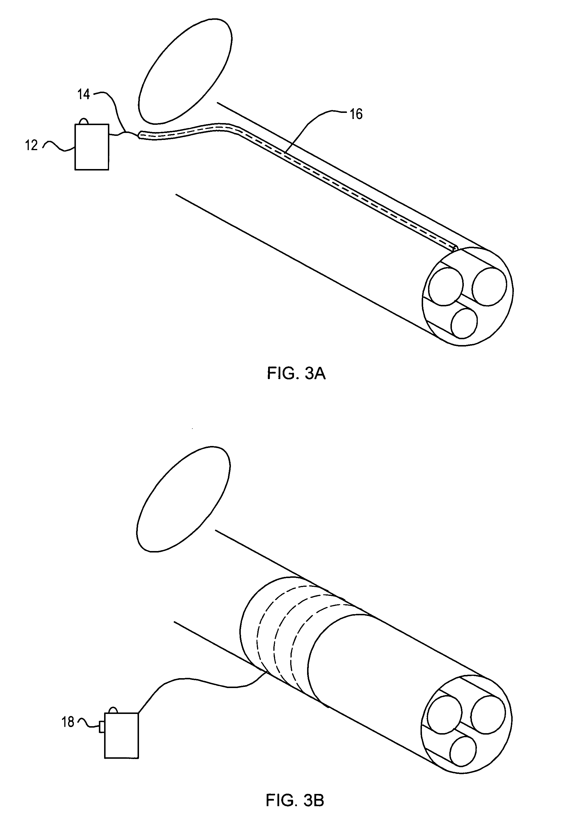 Implantable device and method for managing erectile dysfunction