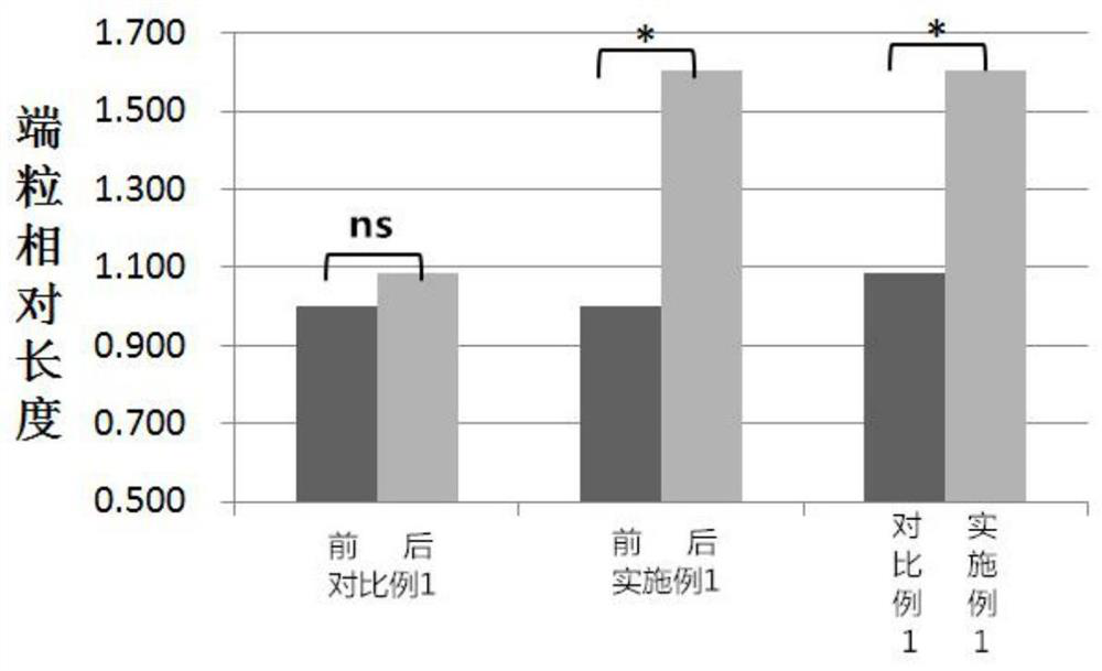 NMN formula product for prolonging chromosome telomere and preparation method thereof