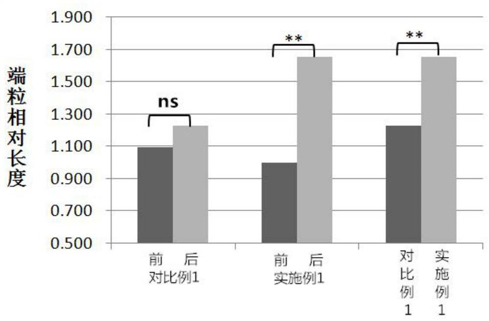 NMN formula product for prolonging chromosome telomere and preparation method thereof