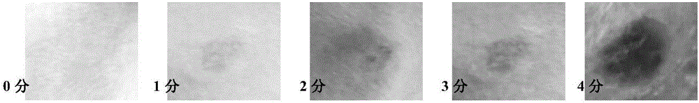 Needle-free injection rabies virus vaccine system and application