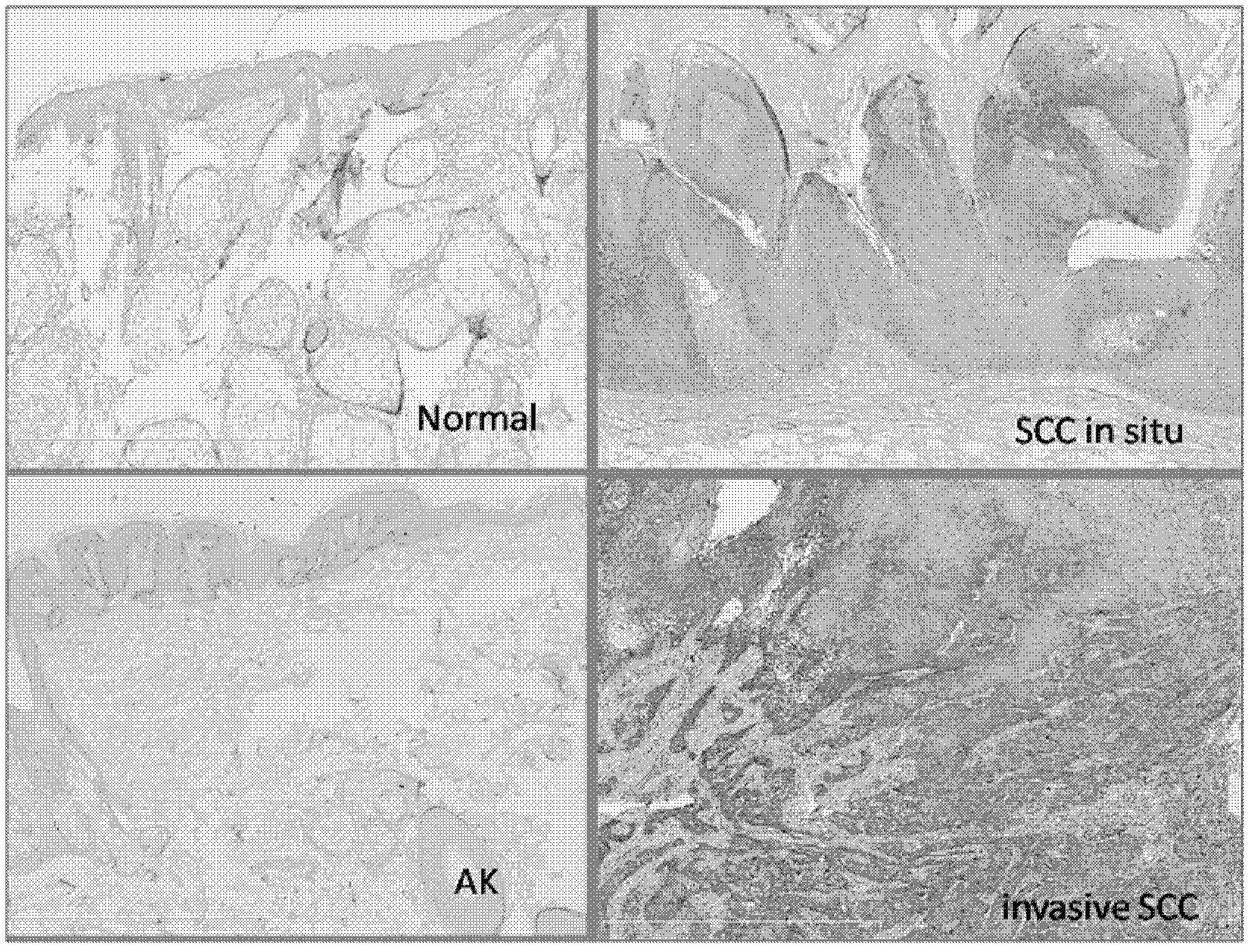 ShRNA of Rab23 and ientiviral vector and applications thereof