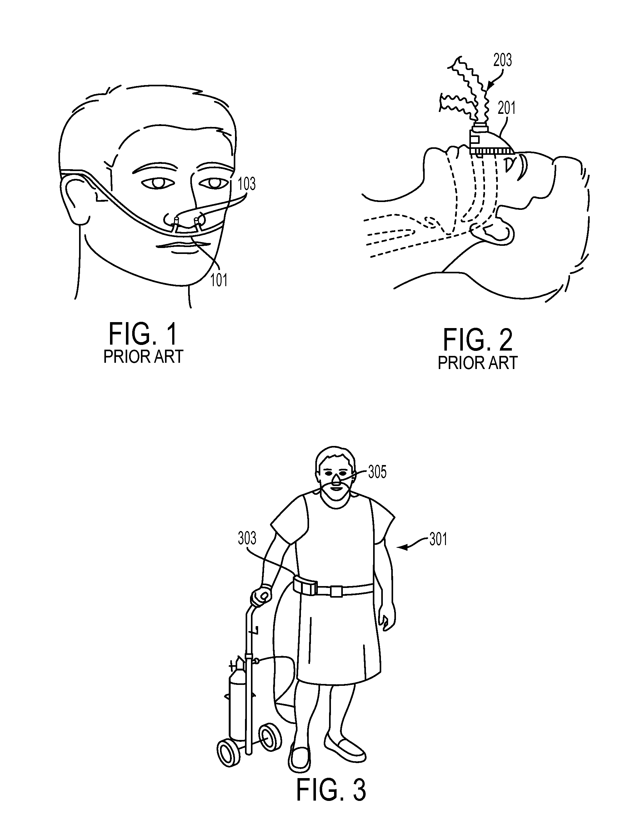 Methods, systems and devices for ventilation using a nasal ventilation mask with a manifold and internal compliant tube and nasal sealing cushion assembly