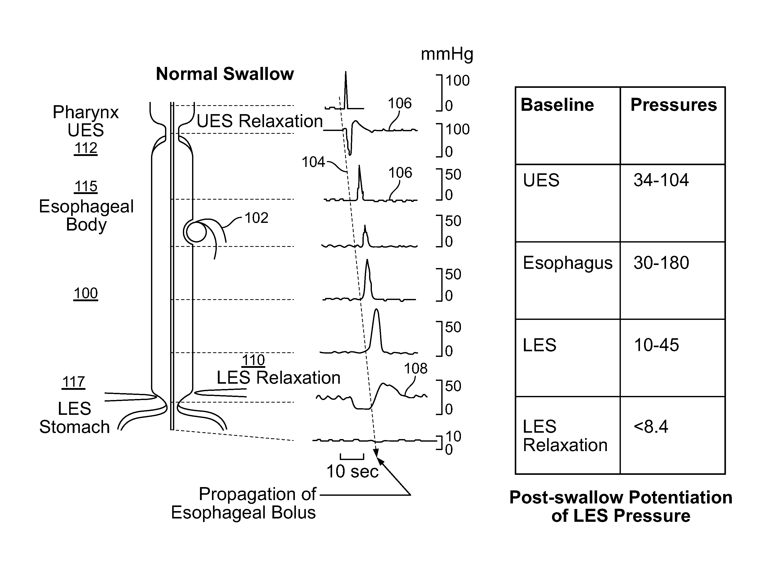 Device and Implantation System for Electrical Stimulation of Biological Systems