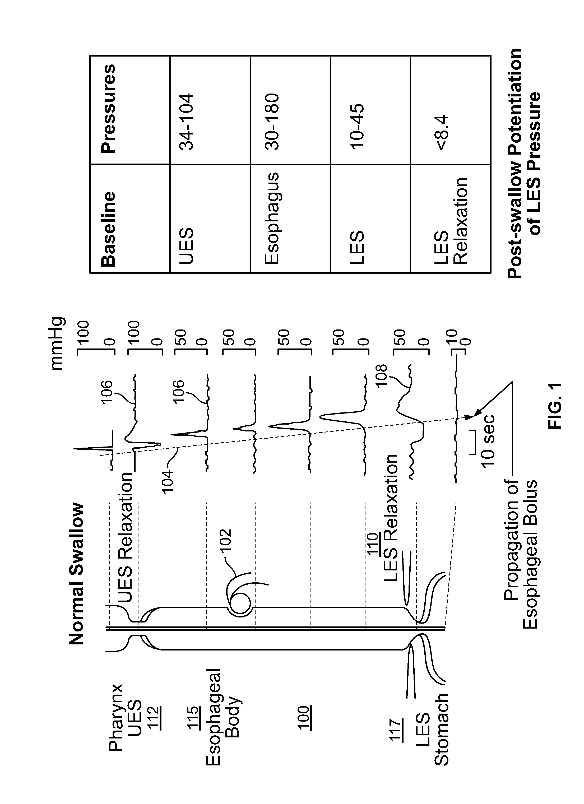 Device and Implantation System for Electrical Stimulation of Biological Systems