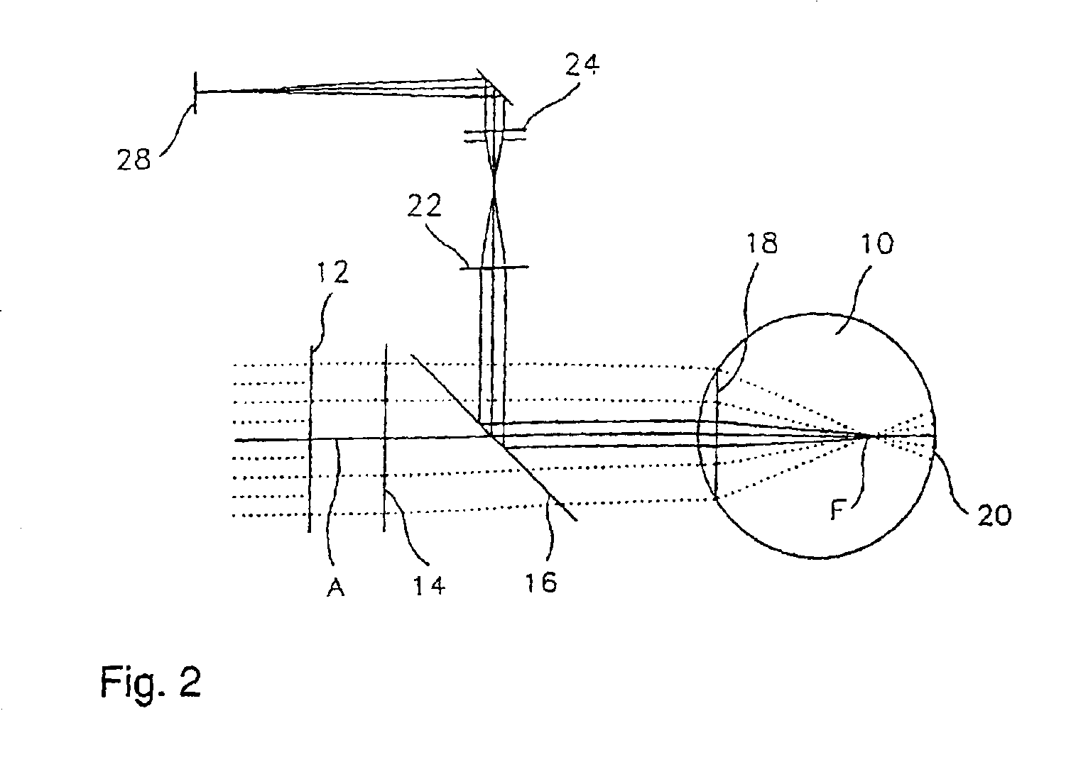 Control program for a device for photorefractive corneal surgery of the eye