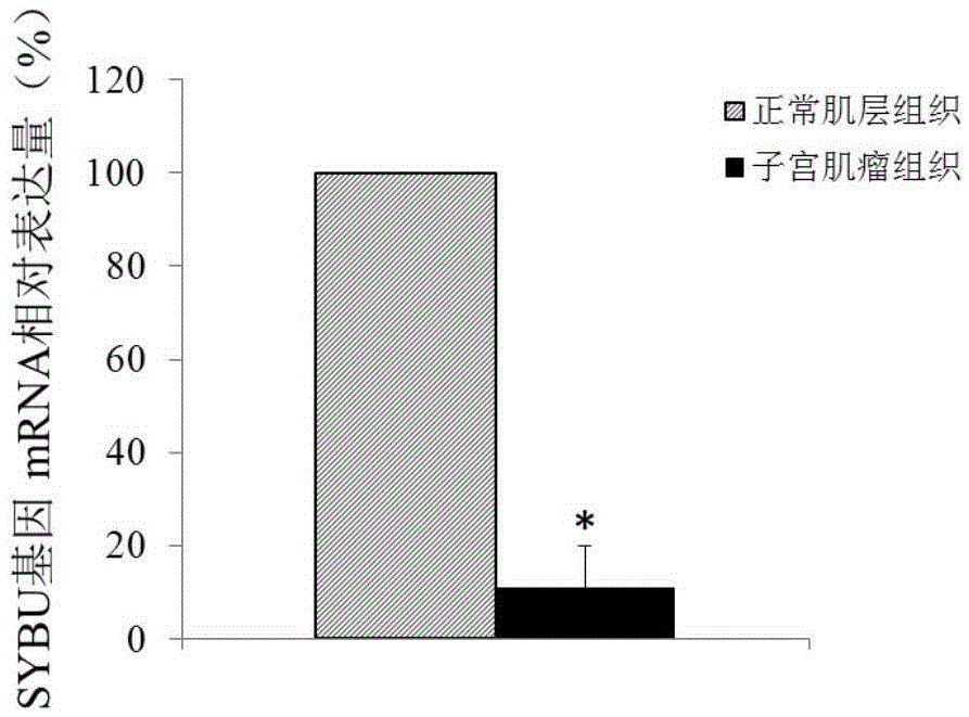 Molecular marker for diagnosing and treating hysteromyoma