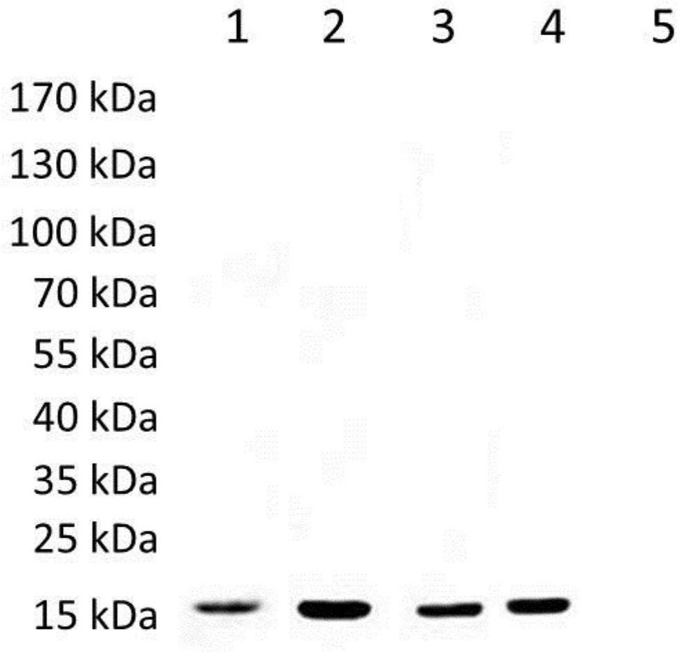 Schistosoma japonicum antigen protein rSjScP15 and application thereof