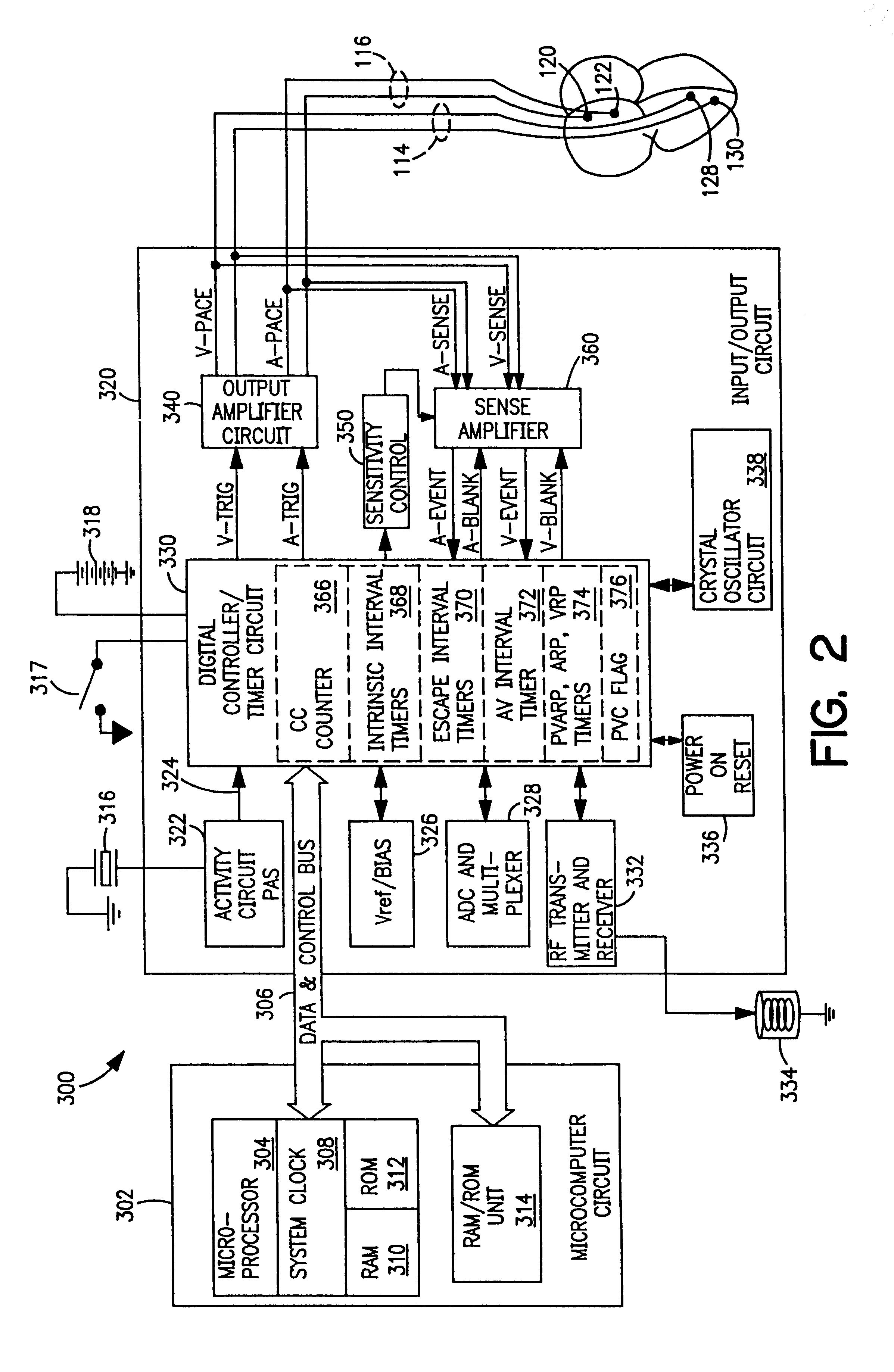 Dual-chamber pacemaker with optimized PVARP following event that may disrupt AV synchrony