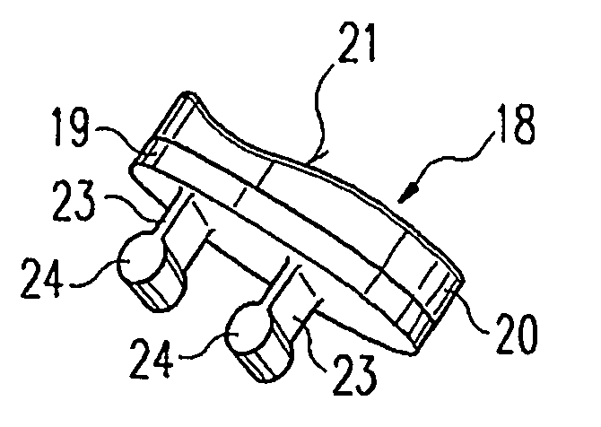 Glenoid prosthesis and method of implanting same