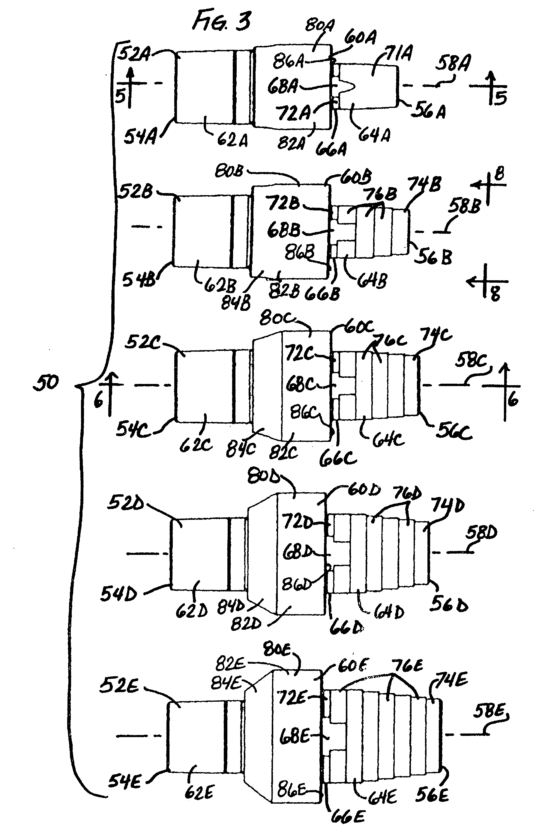 Modular implant system and method with diaphyseal implant