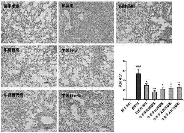 Applications of arctiin and arctigenin in preparation of anti-pulmonary fibrosis drugs