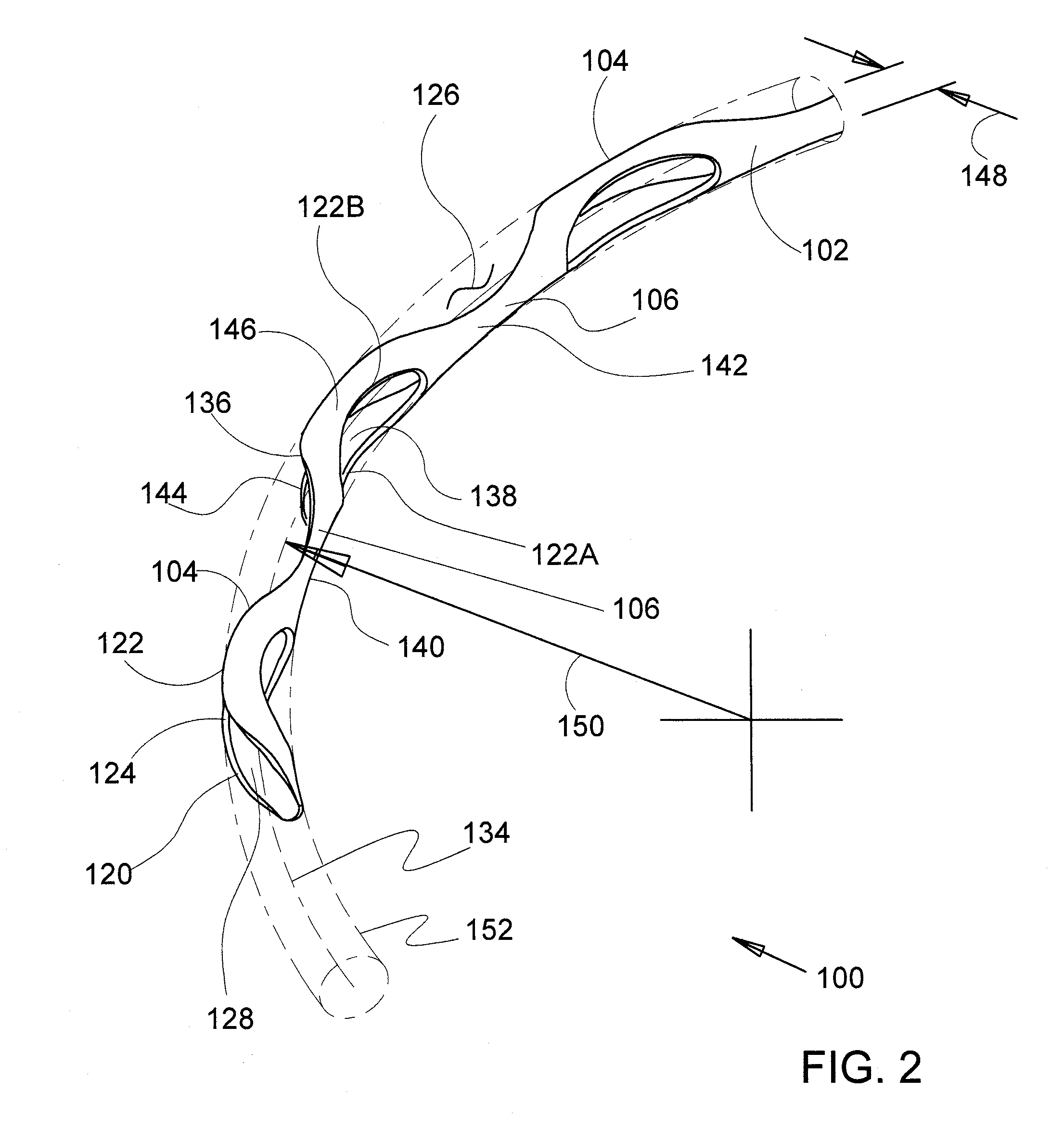 Methods and apparatus for delivering ocular implants into the eye