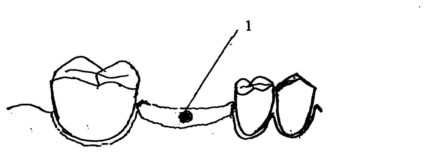 Manufacturing method of surgical guide template for oral cavity planting operation