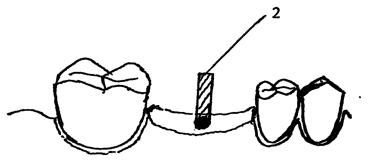 Manufacturing method of surgical guide template for oral cavity planting operation