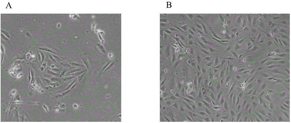 Separation and in vitro amplification method of human vein endothelial cells