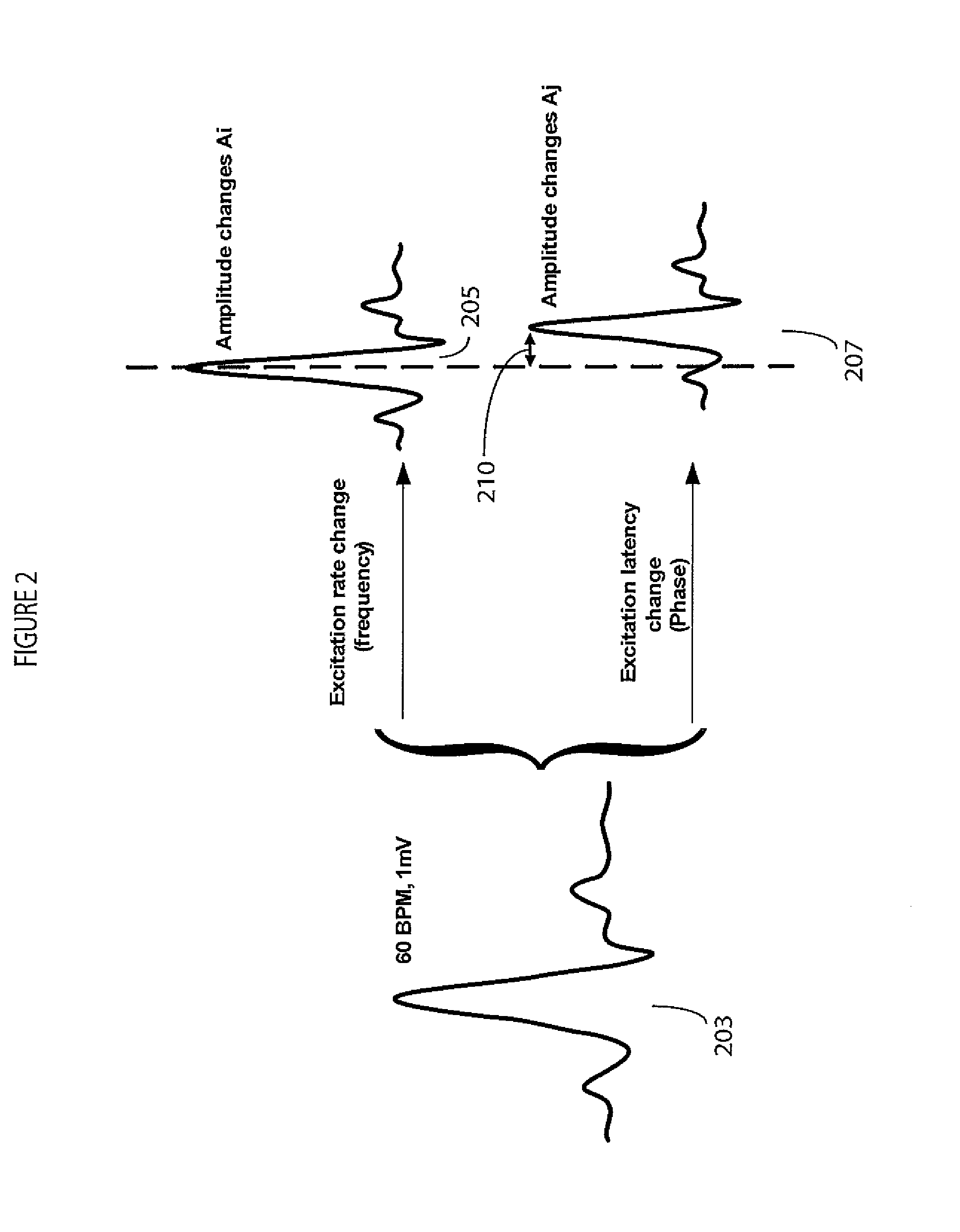 System for cardiac arrhythmia detection and characterization