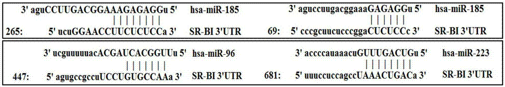 Application of MicroRNA or Its Inhibitors in the Regulation of Lipid Metabolism