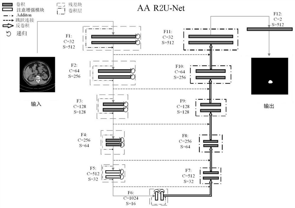 Method for measuring waist 1 vertebral body CT value based on CT image