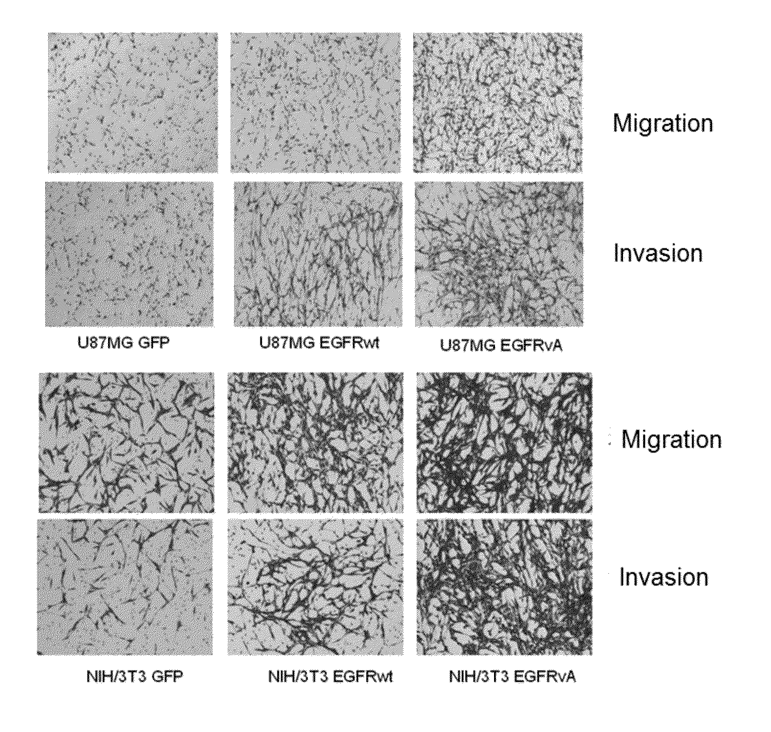 Epidermal growth factor receptor variant