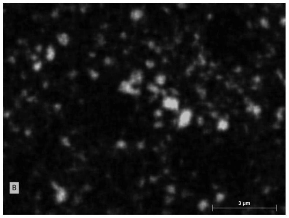 Preparation method of boron particle reinforced metal matrix composite material, composite material and application of composite material