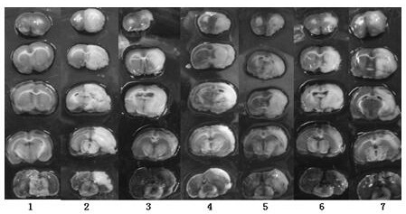 A kind of muscone patch and its preparation method and application