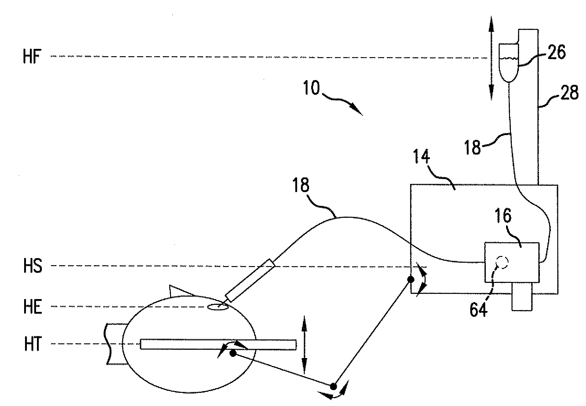 Reversible peristaltic pump and other structures for reflux in eye surgery