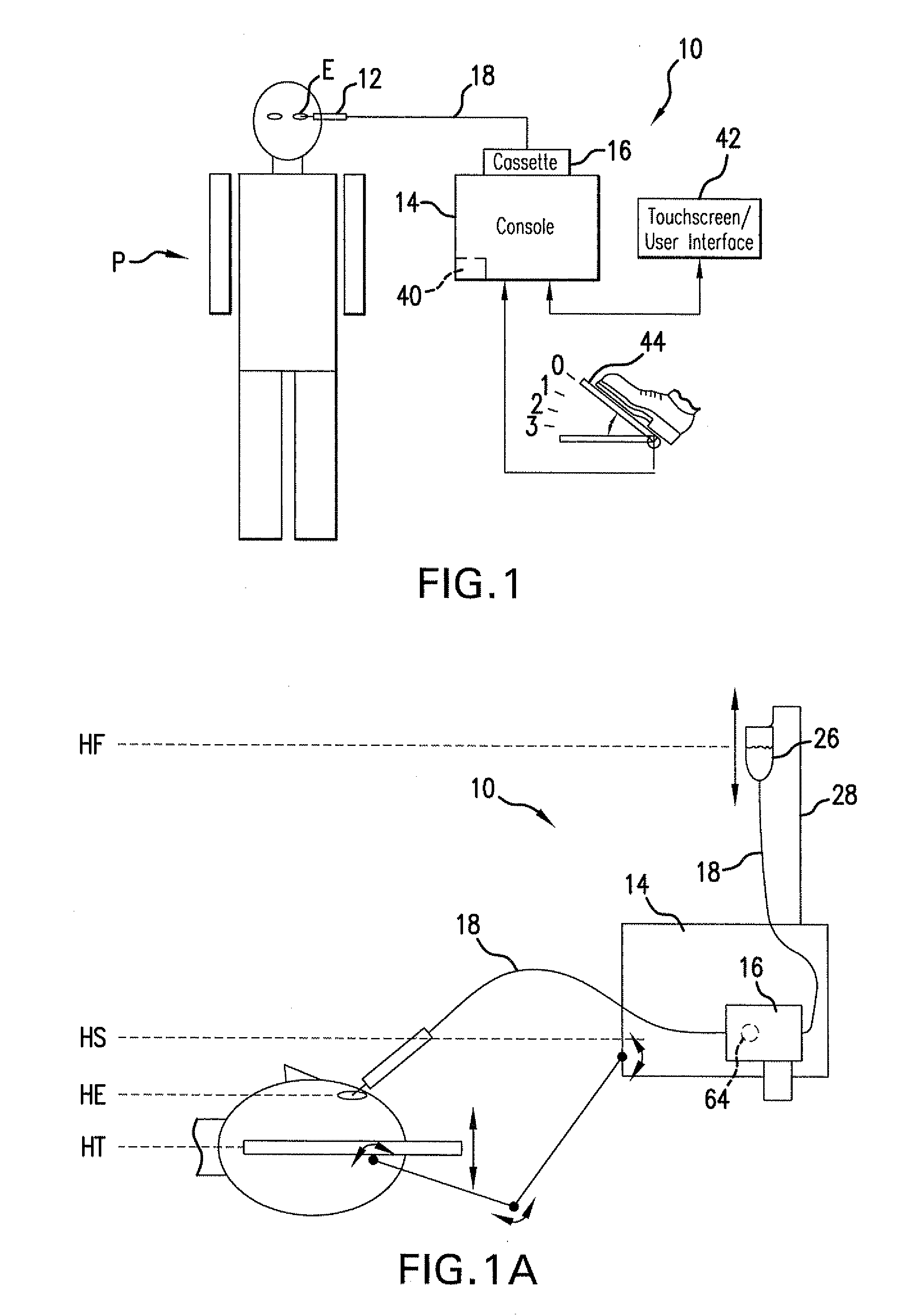 Reversible peristaltic pump and other structures for reflux in eye surgery