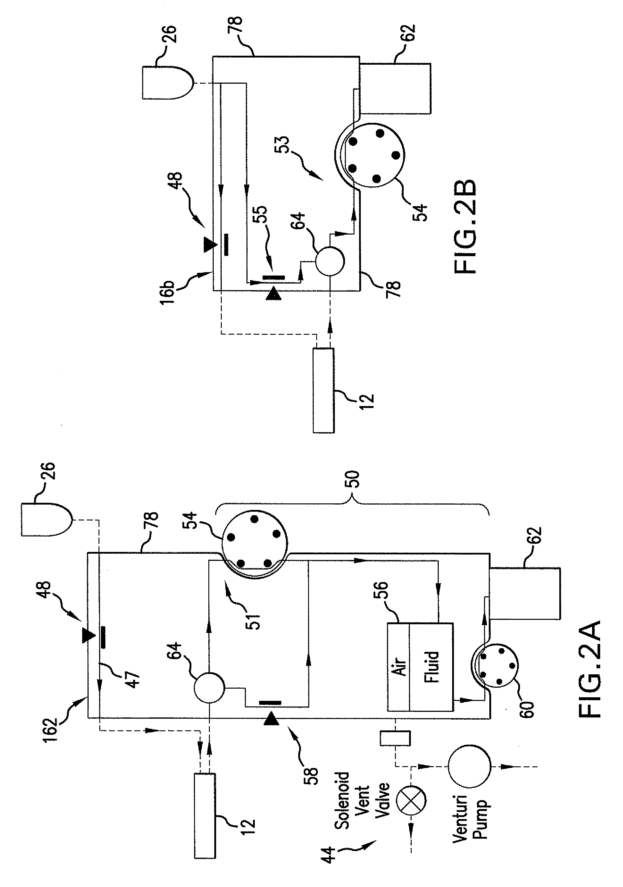 Reversible peristaltic pump and other structures for reflux in eye surgery